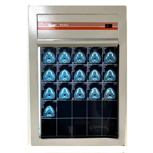 X-RAY VIEWER, WALL MOUNT, SINGLE