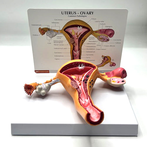 ANATOMICAL UTERUS MODEL ON STAND2