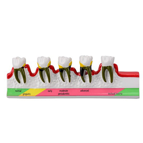 DENTAL PERIODONTAL TEETH MODEL
