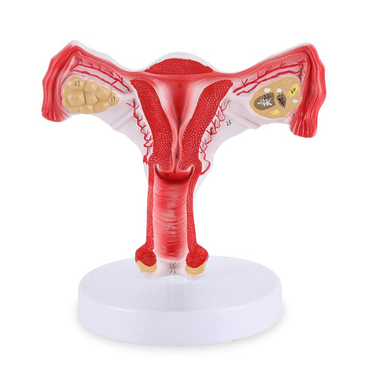 ANATOMICAL UTERUS MODEL ON STAND