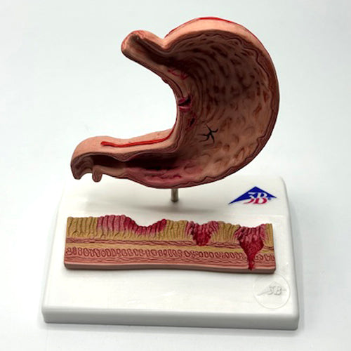 STOMACH MODEL ON STAND