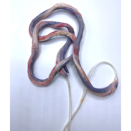 UMBILICAL CORD