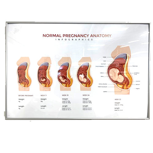 FRAMED POSTER NORMAL PREGNANCY ANATOMY